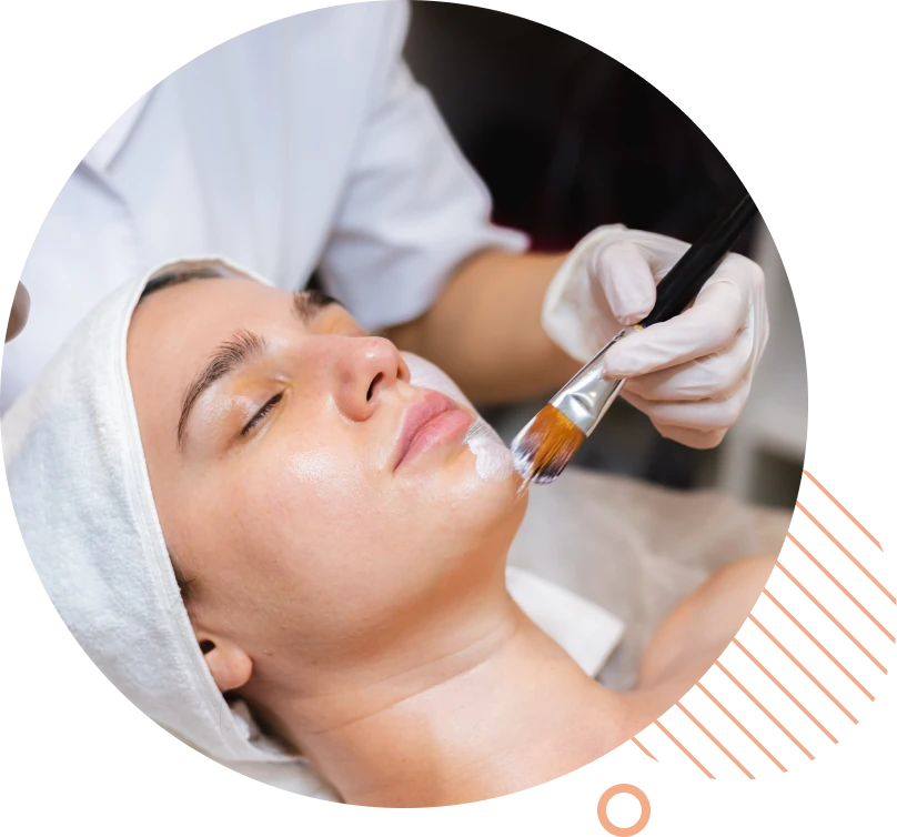 Bioregenerative-Chemical- Peel